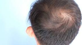 ¿Qué significa tener un remolino dentro del pelo?